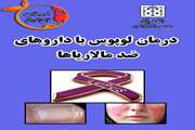 ندای تندرستی/درمان لوپوس با داروهای ضد مالاریاها